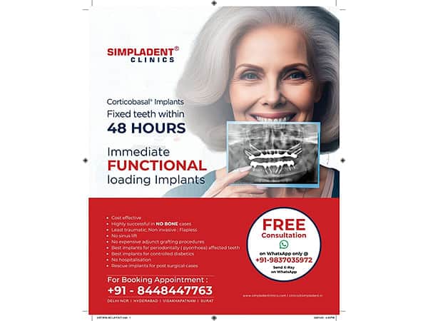 Speedy Loading Dental Implants to Quickly Attain Each Metropolis!