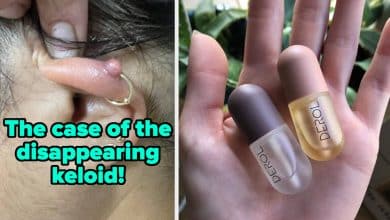 Simply 32 Magnificence Merchandise With Completely Spellbinding Outcomes – BuzzFeed