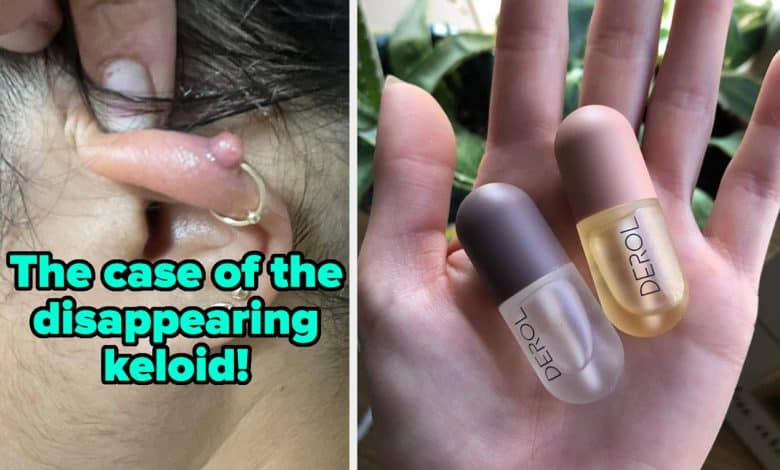 Simply 32 Magnificence Merchandise With Completely Spellbinding Outcomes – BuzzFeed
