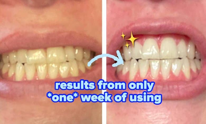 36 Magnificence Merchandise That Have No Proper To Work As Properly As They Do