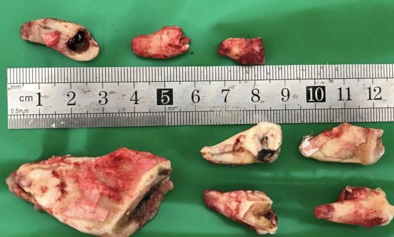 Docs carry out life-saving dental surgical procedure on 900-pound bear – San Francisco Examiner