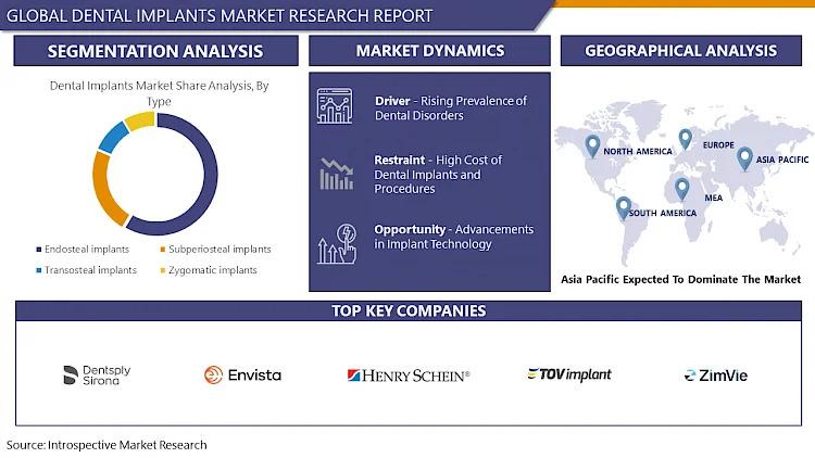 Dental Implants Market is projected to surge forward at a CAGR