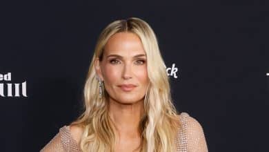 YSE Magnificence’s New Eye Patches Are Key to ‘Trying Your Greatest,’ In keeping with Molly Sims