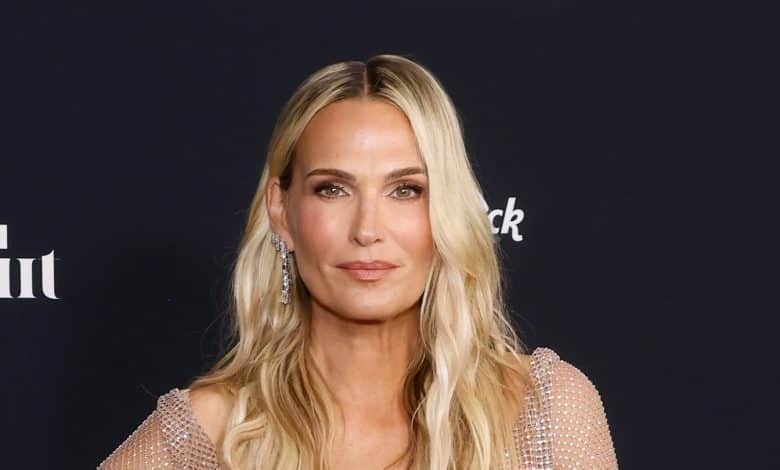 YSE Magnificence’s New Eye Patches Are Key to ‘Trying Your Greatest,’ In keeping with Molly Sims