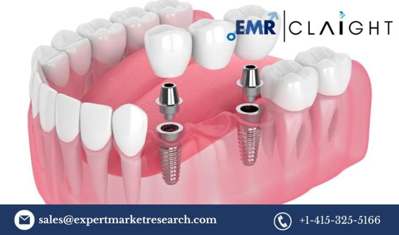 Dental 3D Printing Market Dimension, Share, Report and Forecast