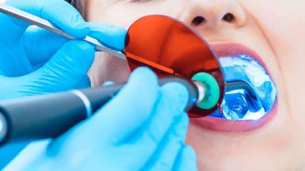 Dental Curing Gentle Market is ready to Fly Excessive Progress in Years